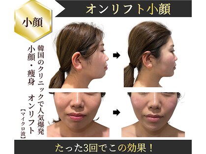 ソラ 天神 大名(SORA)の写真