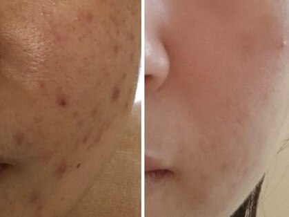 スハダボーテ(Suhada-beaute)の写真
