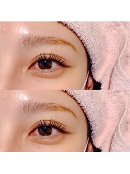 ニコリー(NICOLY)/