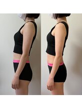 美骨矯正サロン メディカルカイロテルボ 高田馬場店/【肋骨締め・骨盤締め】（痩身）