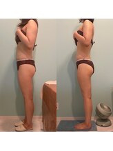 トラスト(TRUST)/全身痩身体験