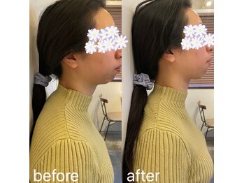 ピエール ナリタイラボ 薬院店(Piel NARITAI LABO)/一度の猫背矯正結果！