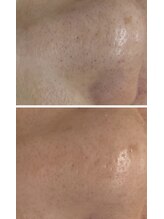 アイラッシュ バイ ポジャ(EYELASH by Poja)/