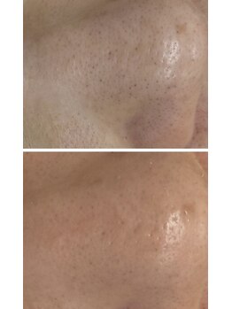 アイラッシュ バイ ポジャ(EYELASH by Poja)/