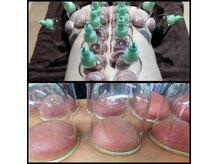 リラクゼーションサロン 粋の雰囲気（【完全個室】カッピングで血流改善◎筋肉疲労の改善に効く！）