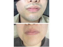 エアリアル 大川店の雰囲気（メンズ人気No. 1ヒゲ脱毛！清潔感アップ、肌まで綺麗に^ ^）