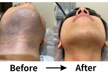 パーミル 楠葉店(per mille‰)