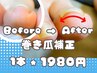 【新メニュー】フット巻爪補正　導入キャンペーン　1本【片足親指】
