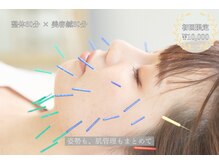 トライム(Trime)の雰囲気（たるみ、エラ張りなどを取り除きフェイスラインくっきり小顔へ）