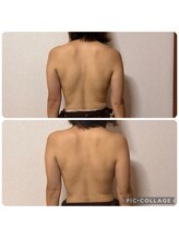 repos_lien【ルポリアン】《リンパマッサージ・よもぎ蒸し》/◇リンパマッサージ　肩こり改善