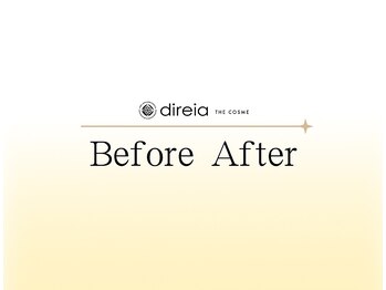 ディレイア ザ コスメ 有楽町マルイ店(direia the cosme)/お客様のBeforeAfter[有楽町駅]