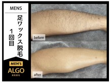 アルゴ 福井店(ALGO)/気になる足もワックス脱毛！