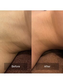 ビビ(VIVI)/首のざらつきにも☆