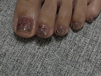 ヴィエル(Vieru)/フットニュアンスデザイン