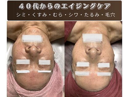 ピュリフィケーション(Purification)の写真