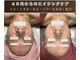 ピュリフィケーション(Purification)の写真