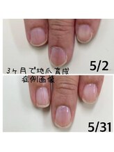 キュアエヌ(cure.n)/☆最強ネイルケアコース☆