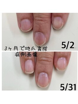 キュアエヌ(cure.n)/☆最強ネイルケアコース☆