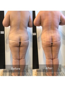 レガリア(LEGAREA)/全身スッキリ【BODYメイク】