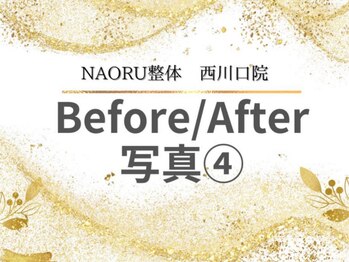 ナオル整体 西川口院(NAORU整体)/西川口 蕨 戸田 整体 骨盤矯正