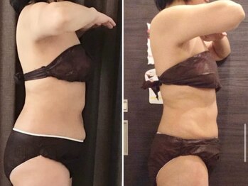 美容整体ウェリナ あま甚目寺院/小顔矯正/骨盤矯正/美脚サロン