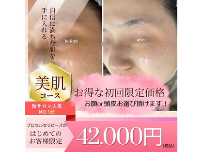 ヒルナム(Heal Nam)の写真
