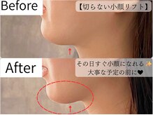 ヒカリエステ 六本木(HIKARI ESTHE)