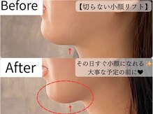 ヒカリエステ 六本木(HIKARI ESTHE)