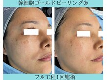 リメイク 広尾(REMAKE)/