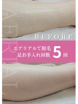 エアリアル 中津店/ブツブツ目立つ毛穴までキレイ♪