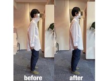 カワル整体 上通り院/座ると尾骨が痛い。