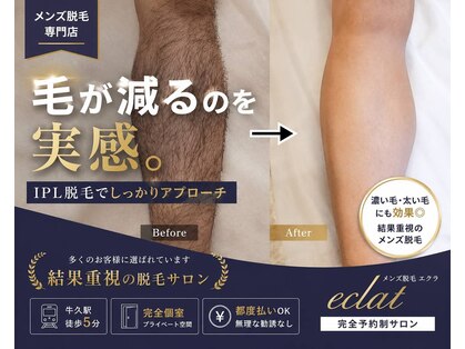 エクラ(eclat)の写真
