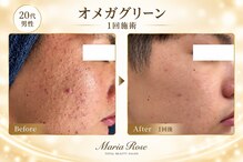 マリアローズ(Maria Rose)