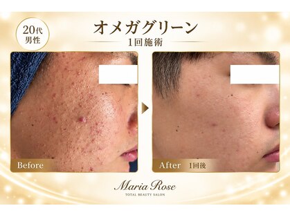 マリアローズ(Maria Rose)の写真
