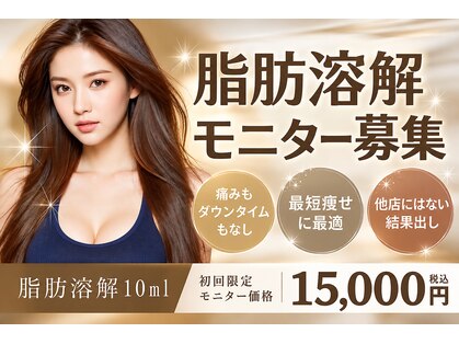 アグテ(Agte)の写真