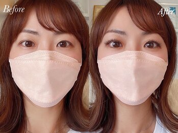 ビューティーアイラッシュサロン アンラッシュ(Beauty AN LASH)/特許技術perfect lash