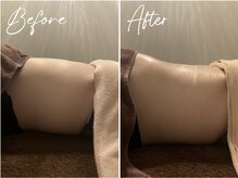 イリアス 藍住店(IRIAS)/before/after＊腸もみ