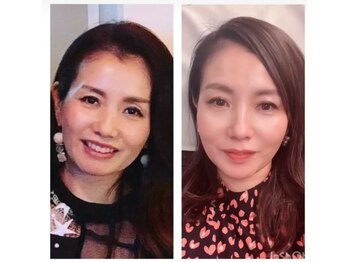 カエラ(KAELA)/ララピール＋光ケア