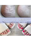 フットジェル1カラー+角質ケア