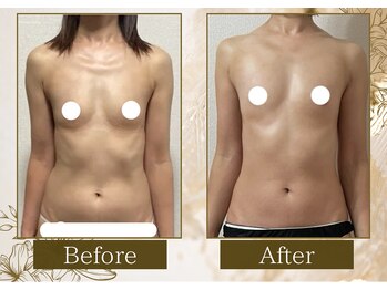 マリン(MARINE)/カラダ若々しくBefore→After