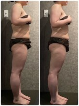 エレラビューティー(ELERA beauty)/お客様before after筋膜リリース