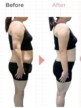 ホッコリ 段原店(HOKKORI)/寝たまま痩身ダイエット