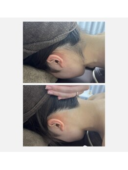 ミース 仙台長町店/うなじ●ビフォーアフター