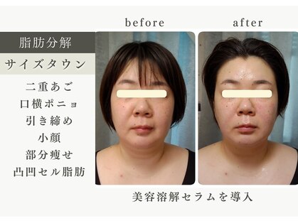 ティアス(t-us)の写真