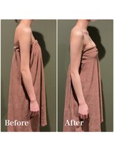 ロココ 大宮店(Rococo)/一回でここまで変わる姿勢改善