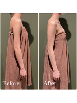 ロココ 大宮店(Rococo)/一回でここまで変わる姿勢改善