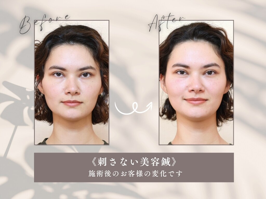 ビヨウフォーウーマン(Biyo For Women)｜ホットペッパービューティー