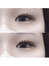 アネラ 表参道(Anela)/