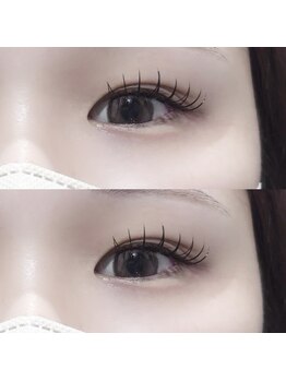 アネラ 表参道(Anela)/