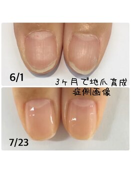 キュアエヌ(cure.n)/☆最強ネイルケアコース☆